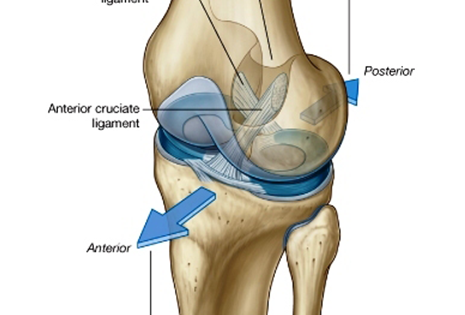Ozljeda meniskusa jedna je od najčešćih ozljeda koljena, posebno kod sportaša i sportaša